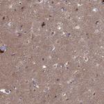 CDK5 Antibody in Immunohistochemistry (Paraffin) (IHC (P))