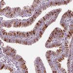 CDS1 Antibody in Immunohistochemistry (Paraffin) (IHC (P))