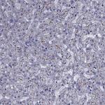 SLC30A10 Antibody in Immunohistochemistry (Paraffin) (IHC (P))