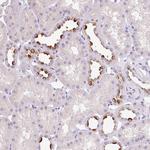 ATP6V0A4 Antibody in Immunohistochemistry (Paraffin) (IHC (P))