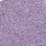 RASA1 Antibody in Immunohistochemistry (Paraffin) (IHC (P))