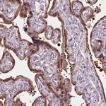 RASA1 Antibody in Immunohistochemistry (Paraffin) (IHC (P))