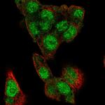 ChREBP Antibody in Immunocytochemistry (ICC/IF)