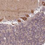 HS3ST5 Antibody in Immunohistochemistry (Paraffin) (IHC (P))