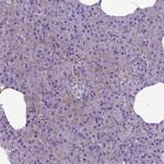 MVP Antibody in Immunohistochemistry (Paraffin) (IHC (P))