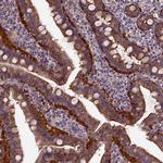 MVP Antibody in Immunohistochemistry (Paraffin) (IHC (P))