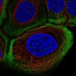 MYH9 Antibody in Immunocytochemistry (ICC/IF)