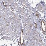 MYH9 Antibody in Immunohistochemistry (Paraffin) (IHC (P))