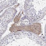 MYH9 Antibody in Immunohistochemistry (Paraffin) (IHC (P))