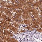 UGP2 Antibody in Immunohistochemistry (Paraffin) (IHC (P))