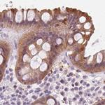 UGP2 Antibody in Immunohistochemistry (Paraffin) (IHC (P))