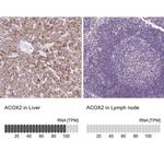 ACOX2 Antibody