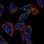 ACOX2 Antibody in Immunocytochemistry (ICC/IF)