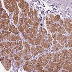 ACOX2 Antibody in Immunohistochemistry (Paraffin) (IHC (P))