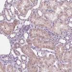 ACOX2 Antibody in Immunohistochemistry (Paraffin) (IHC (P))