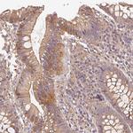 RALA Antibody in Immunohistochemistry (Paraffin) (IHC (P))