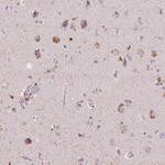 CXCL5 Antibody in Immunohistochemistry (Paraffin) (IHC (P))