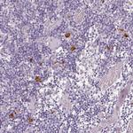 CXCL5 Antibody in Immunohistochemistry (Paraffin) (IHC (P))