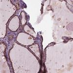 DNase II Antibody in Immunohistochemistry (Paraffin) (IHC (P))