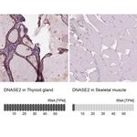 DNase II Antibody