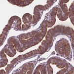 A-Raf Antibody in Immunohistochemistry (Paraffin) (IHC (P))