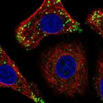 DULLARD Antibody in Immunocytochemistry (ICC/IF)