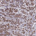 RIM2 Antibody in Immunohistochemistry (Paraffin) (IHC (P))