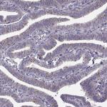 RIM2 Antibody in Immunohistochemistry (Paraffin) (IHC (P))