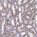 RIM2 Antibody in Immunohistochemistry (Paraffin) (IHC (P))