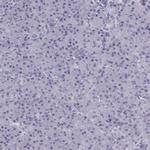 RIM2 Antibody in Immunohistochemistry (Paraffin) (IHC (P))