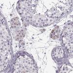 RIM2 Antibody in Immunohistochemistry (Paraffin) (IHC (P))