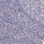 NHERF2 Antibody in Immunohistochemistry (Paraffin) (IHC (P))