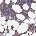 Neutrophil elastase Antibody in Immunohistochemistry (Paraffin) (IHC (P))