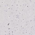 Neutrophil elastase Antibody in Immunohistochemistry (Paraffin) (IHC (P))