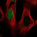 HES1 Antibody in Immunocytochemistry (ICC/IF)