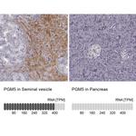 PGM5 Antibody