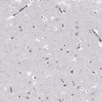 PGM5 Antibody in Immunohistochemistry (Paraffin) (IHC (P))