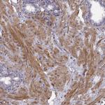 PGM5 Antibody in Immunohistochemistry (Paraffin) (IHC (P))