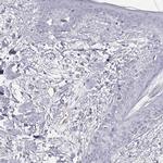 PGM5 Antibody in Immunohistochemistry (Paraffin) (IHC (P))