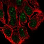 ESRP1 Antibody in Immunocytochemistry (ICC/IF)