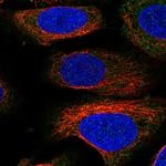 Munc13-4 Antibody in Immunocytochemistry (ICC/IF)