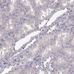 Munc13-4 Antibody in Immunohistochemistry (Paraffin) (IHC (P))