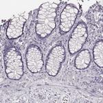 KRT82 Antibody in Immunohistochemistry (Paraffin) (IHC (P))