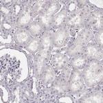 KRT82 Antibody in Immunohistochemistry (Paraffin) (IHC (P))