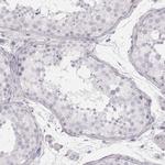 KRT82 Antibody in Immunohistochemistry (Paraffin) (IHC (P))