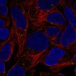 GPR98 Antibody in Immunocytochemistry (ICC/IF)