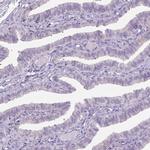 GPR98 Antibody in Immunohistochemistry (Paraffin) (IHC (P))