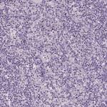 GPR98 Antibody in Immunohistochemistry (Paraffin) (IHC (P))