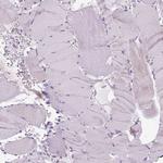 GPR98 Antibody in Immunohistochemistry (Paraffin) (IHC (P))