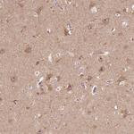 PARP3 Antibody in Immunohistochemistry (Paraffin) (IHC (P))